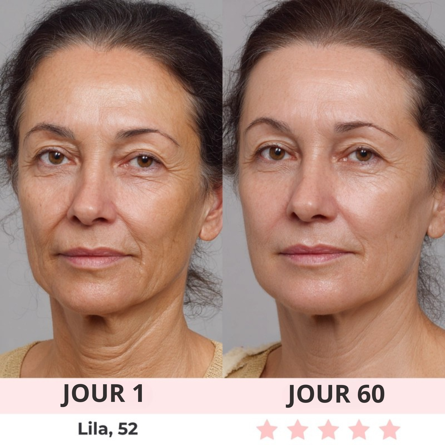 OLYANA LISSEUR FACIAL LED 2.0